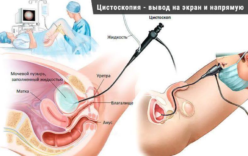 5 неловких вопросов, которые вы боялись задать сексологу » Gossip UA - женский журнал