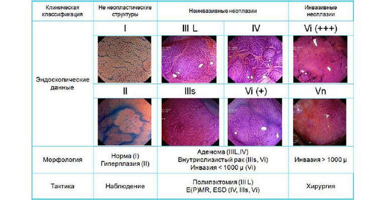Классификация форест