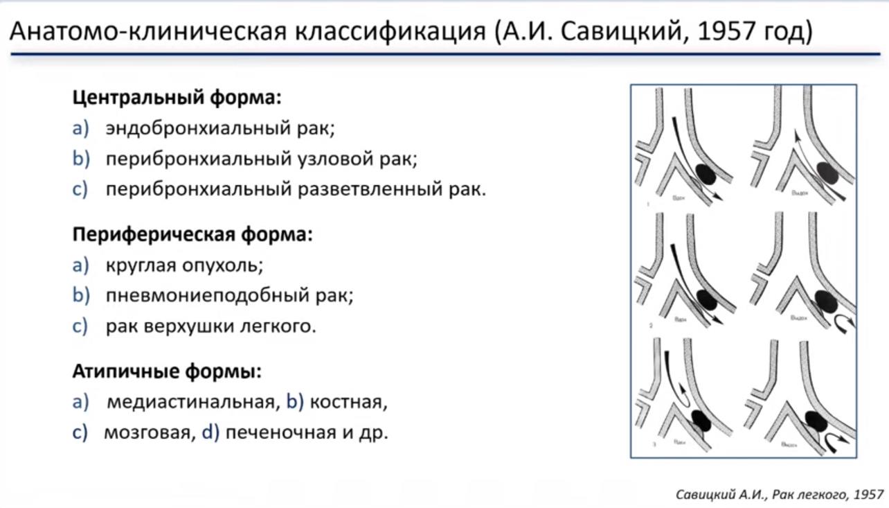 Анатомо-клиническая классификация рака легкого (А.И. Савицкий, 1957 год)