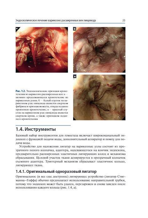 Терапевтическая эндоскопия желудочно-кишечного тракта. Атлас. Х.Дж. Чун, С.К. Янг, М.Г. Чой