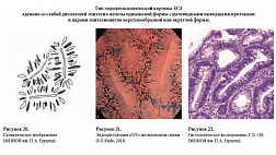 ЭНДОЦИТОСКОПИЯ - НОВЫЙ МЕТОД ЭНДОСКОПИЧЕСКОГО ИССЛЕДОВАНИЯ ОРГАНОВ ЖЕЛУДОЧНО-КИШЕЧНОГО ТРАКТА И ДЫХАТЕЛЬНЫХ ПУТЕЙ
