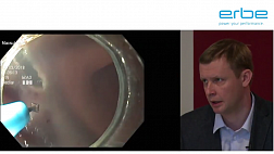 Режимы и настройки коагуляторов Erbe Elektromedizin для эндоскопии какие Я использую Ткаченко О.Б.