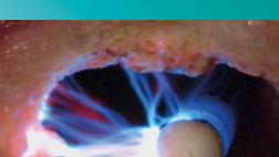 Справочник по электрохирургии в эндоскопии ERBE