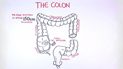 Патогенез болезни Крона в стихах