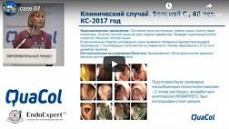 Рекомендации по ведению пациентов после выполнения колоноскопии и удаления полипов (Нехайкова Н.В.)