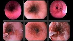 ФЕДЕРАЛЬНЫЕ КЛИНИЧЕСКИЕ РЕКОМЕНДАЦИИ «Токсическое действие разъедающих веществ», «Токсическое действие мыл и детергентов» 2014