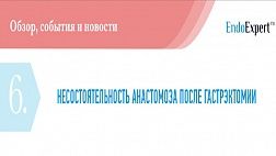 НЕСОСТОЯТЕЛЬНОСТЬ АНАСТОМОЗА ПОСЛЕ ГАСТРЭКТОМИИ