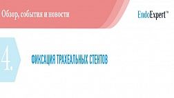 ФИКСАЦИЯ ТРАХЕАЛЬНЫХ СТЕНТОВ