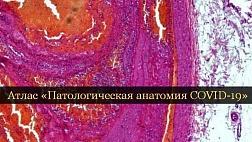 Атлас «Патологическая анатомия COVID-19»