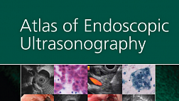 Atlas of Endoscopic Ultrasonography Gress Savides 2012