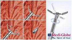 Новая одноразовая cистема клипирования для гемостаза - CrownClip c вращающимися браншами клипатора