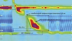 Манометрия пищевода высокого разрешения. Методические рекомендации. 2018