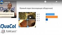 Интерактивная видео сессия (модератор: Качество подготовки кишечника. Морфологические классификации, Техника полипэктомии