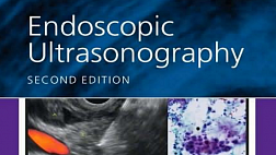 Endoscopic Ultrasonography FRANK G. GRESS, THOMAS J. SAVIDES. SECOND EDITION