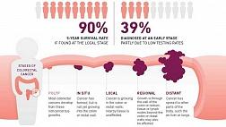 Колоректальный рак — вопросы заболеваемости и эпидемиологии