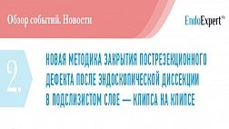 НОВАЯ МЕТОДИКА ЗАКРЫТИЯ ПОСТРЕЗЕКЦИОННОГО ДЕФЕКТА ПОСЛЕ ЭНДОСКОПИЧЕСКОЙ ДИССЕКЦИИ В ПОДСЛИЗИСТОМ СЛОЕ — КЛИПСА НА КЛИПСЕ
