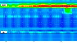 Пополнение раздела Библиотека. Статья: Роль функциональных методов исследования в диагностике и выборе лечения гастроэзофагеальной рефлюксной болезни и ее осложнений В. О. Кайбышева С. Г. Шаповальянц
