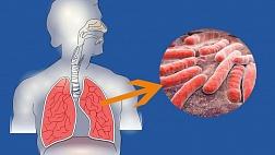 Туберкулез. Что такое туберкулез, механизмы передачи возбудителя туберкулеза, методы лечения туберкулеза, профилактика туберкулеза?