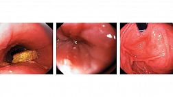 ПЕРВЫЙ В УКРАИНЕ ПОЭМ В.Яковенко