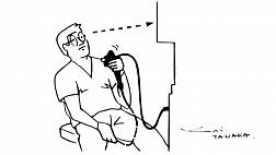Колоноскопия в сидячем положении: уроки, извлеченные из самостоятельной колоноскопии с использованием небольшого калибра колоноскопа переменной жесткости. SelfieColonoscopy