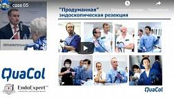 Эндоскопические методики удаления полипов толстой кишки (полипэктомия и эндоскопическая резекция): показания, техника выполнения, профилактика осложнений (Кашин С.В.)