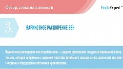 ВАРИКОЗНОЕ РАСШИРЕНИЕ ВЕН