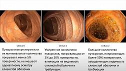 Что такое Colon Endoscopic Bubble Scale (шкала CEBuS)?