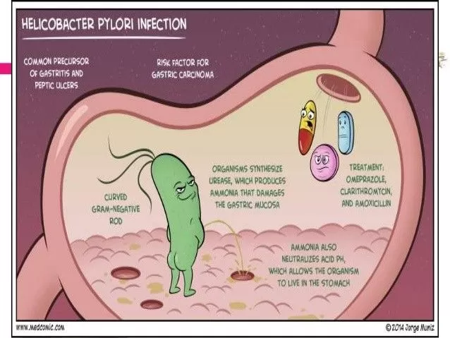 helicobacter-pylori-4-638.jpg