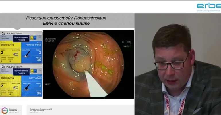 ErbeEndoExpertAVE18SH.png ErbeEndoExpertAVE18SH.png