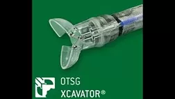 Что такое OTSG Xcavator® ?