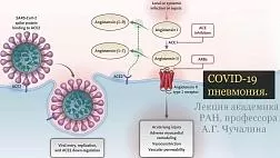 Обзор и актуальная информация о COVID-19 пневмонии. Лекция академика РАН, профессора А.Г. Чучалина ноябрь 2020