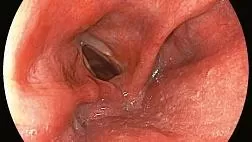 Принципы и практика для облегчения полной фотодокументации верхних отделов желудочно-кишечного тракта: заявление о позиции Всемирной эндоскопической организации WEO 2019. Система SACE. Видео и статья.