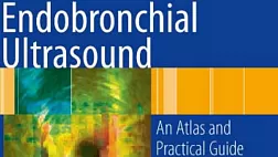 Endobronchial Ultrasound - An Atlas And Practical Guide 1st ed 2009 Ernst Herth