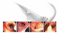 Гибкая диагностическая бронхоскопия