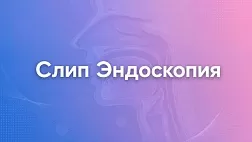 Исследование верхних дыхательных путей во время медикаментозного сна. Слип-эндоскопия.