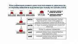 Классификация раннего рака толстой кишки в зависимости от глубины инвазии в подслизистую основу по Кудо (S.Kudo 1993)