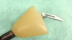 ТАКТИЧЕСКИЕ АСПЕКТЫ ДИАГНОСТИКИ И ЛЕЧЕНИЯ ПАЦИЕНТОВ С ИНОРОДНЫМИ ТЕЛАМИ В ВЕРХНИХ ОТДЕЛАХ ЖЕЛУДОЧНО-КИШЕЧНОГО ТРАКТА