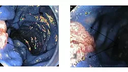 Возможности хромоскопии Краснодар