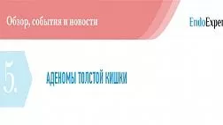 АДЕНОМЫ ТОЛСТОЙ КИШКИ