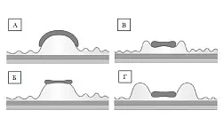 Классификация H. Kato для оценки степени лифтинга слизистой