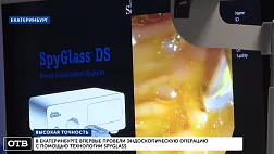 Аппарата SpyGlass в Екатеринбурге. Демонстрация работы в рамках второго Евразийского форума «УралЭндо».
