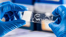 Действующие МУ 4.2.2039-05 Техника сбора и транспортирования биоматериалов в микробиологические лаборатории