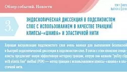 ЭНДОСКОПИЧЕСКАЯ ДИССЕКЦИЯ В ПОДСЛИЗИСТОМ СЛОЕ С ИСПОЛЬЗОВАНИЕМ В КАЧЕСТВЕ ТРАКЦИИ КЛИПСЫ-«ШКИВА» И ЭЛАСТИЧНОЙ НИТИ