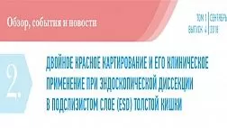 ДВОЙНОЕ КРАСНОЕ КАРТИРОВАНИЕ И ЕГО КЛИНИЧЕСКОЕ ПРИМЕНЕНИЕ ПРИ ЭНДОСКОПИЧЕСКОЙ ДИССЕКЦИИ В ПОДСЛИЗИСТОМ СЛОЕ (ESD) ТОЛСТОЙ КИШКИ