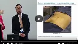 Профилактика и лечение осложнений при диагностической и лечебной колоноскопии. Ф. Эмура