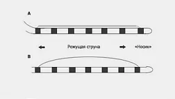 Эндоскопическая папиллосфинктеротомия. Технические аспекты