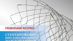 EndoExpert дайджест Эндоскопии 6 номер. Интернет журнал. EndoExpert Digest Endoscopy