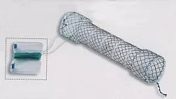 Эндоскопическое протезирование стенозов пищевода и кардии саморасправляющимися металлическими стентами