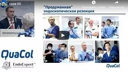 Эндоскопические методики удаления полипов толстой кишки (полипэктомия и эндоскопическая резекция): показания, техника выполнения, профилактика осложнений (Кашин С.В.)