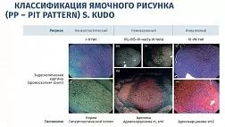 Азбука Эндоскописта. Эндоскопические классификации для описания и оценки патологических изменений толстой кишки при колоноскопии